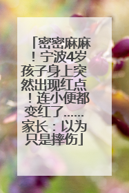 密密麻麻！宁波4岁孩子身上突然出现红点！连小便都变红了……家长：以为只是摔伤